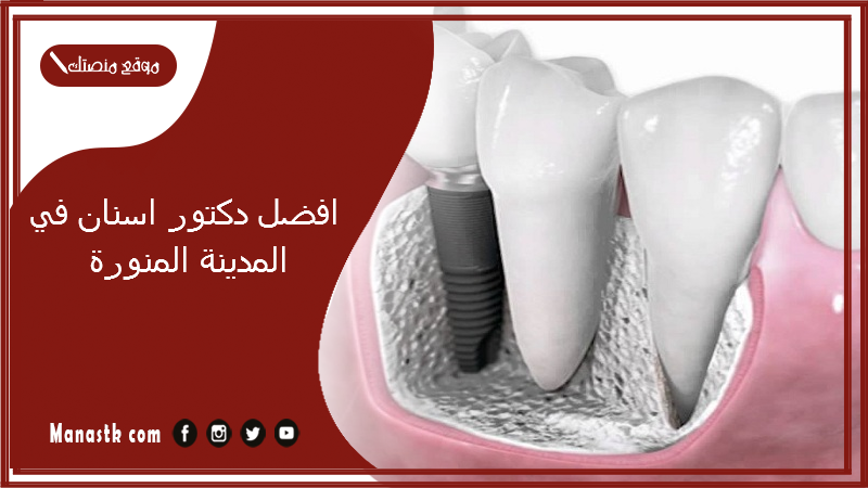 افضل دكتور اسنان في المدينة المنورة