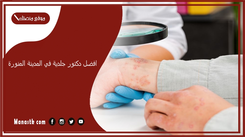 افضل دكتور جلدية في المدينة المنورة