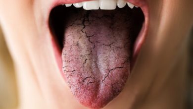 علاج جفاف الحلق وأسباب حدوثة
