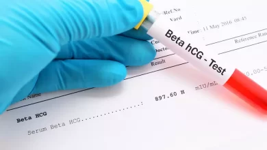 تحليل b-hcg