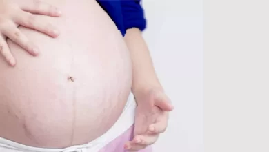 ما هي أبرز علامات الشد خلال الحمل والعلاج